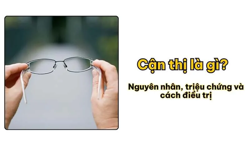 Cận thị là tật khúc xạ khiến người mắc nhìn gần rõ nhưng nhìn xa bị mờ, cần được phát hiện và chăm sóc mắt đúng cách.