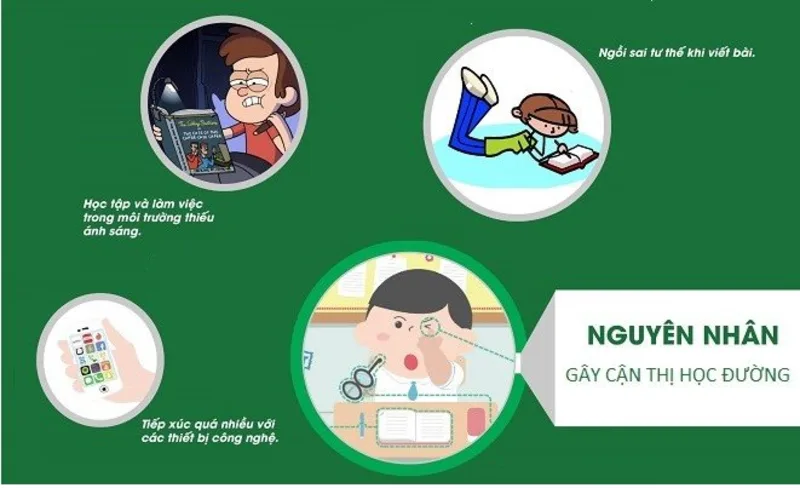 Cận thị thường liên quan đến di truyền, thói quen nhìn gần kéo dài, thiếu hoạt động ngoài trời và tư thế học tập chưa đúng.